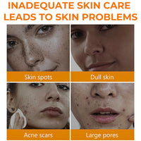 IZBEAUVO Turmeric Face Toner, Dark Spots Skin Toner for Face, Pore Minimizer Hydrating Toner, Face Exfoliator, Clean and Clear Facial Toner for Reduce Dark Spots & Acne, Brighten, Turmeric Oil Moisturiser