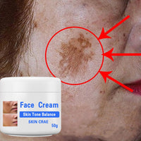 GNAUMORE Dark Spot Corrector Cream,Sun Spots and Melasma Freckle Remover,Spot Remover For Face Serum,Moisturizing Removes Facial Melasma Dark Spots Wrinkles Blemishes 50G