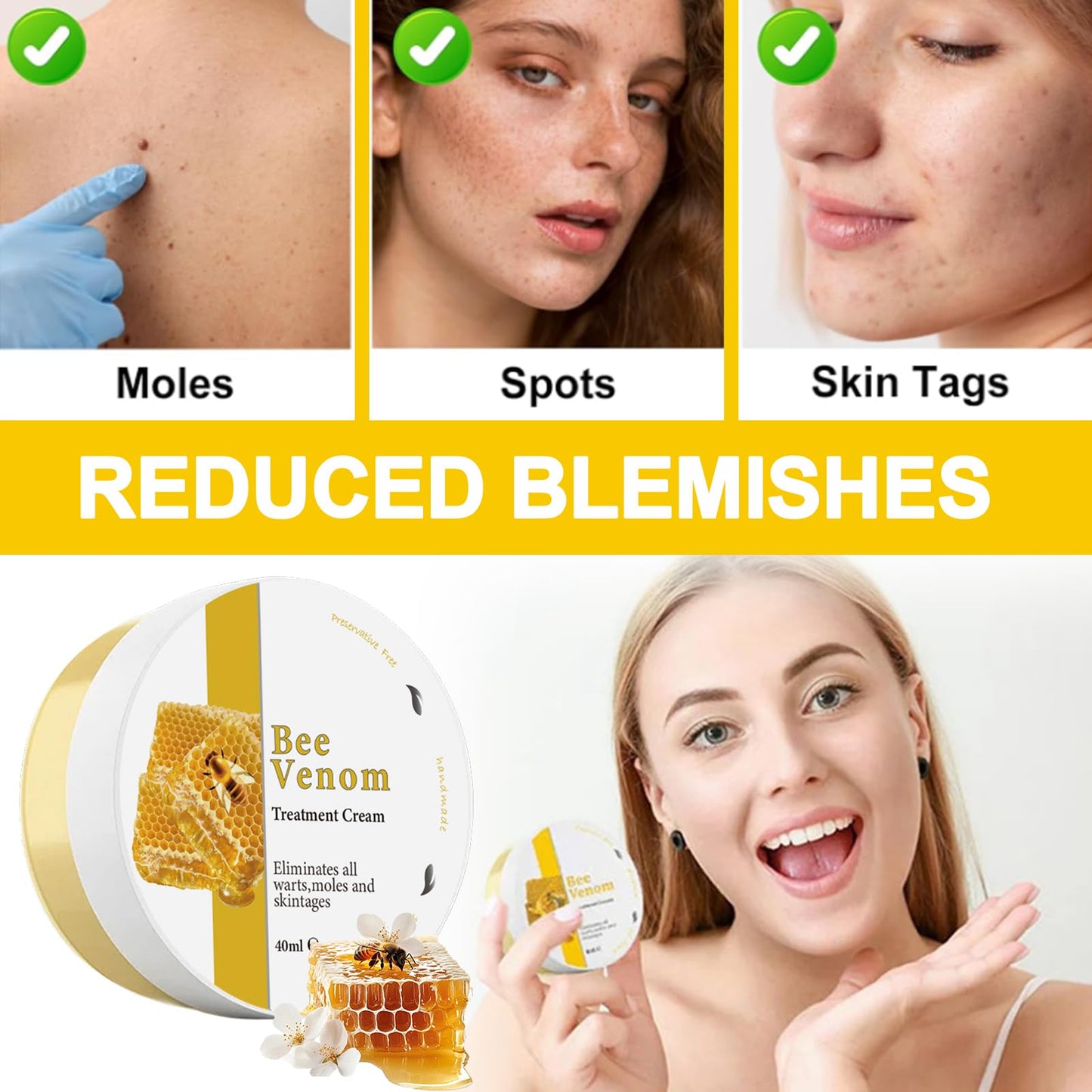 Trendyfave Bee Venom Cream, Bee Venom Skin Treatment Cream, Skin Repair, Enriched with Bee Venom & Natural Extracts, Body Moisturiser, Revitalises Skin, Suitable for All Skin Types, 2Pcs