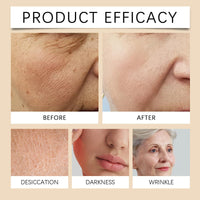 100g Jorondy Firming Cream, 2025 New Advanced Skin Firming Cream, Anti Wrinkle, Tightening and Lifting, Improves skin Sagging, Smooths Wrinkles and Fine Lines