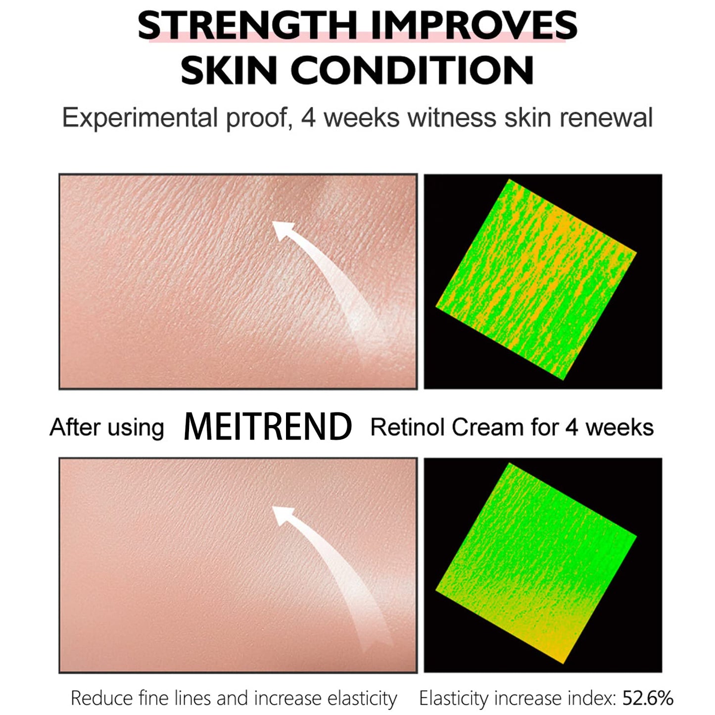 Retinol Cream - Face Cream Anti-Aging Wrinkle Night/Day Cream With 2.5% Retinol - Eye Face Moisturiser to Help Skin Regenerating Reduce Wrinkles, Fine Lines, Dry Skin Age Spots 30ml
