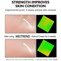 Retinol Cream - Face Cream Anti-Aging Wrinkle Night/Day Cream With 2.5% Retinol - Eye Face Moisturiser to Help Skin Regenerating Reduce Wrinkles, Fine Lines, Dry Skin Age Spots 30ml
