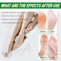 Neyeau 5 Pairs Foot Peel Mask for Hard Skin, Exfoliating Foot Peel Mask, Callus Remover, Aloe Deep Hydration, Nourishing, Repairing, for Daily Foot Care