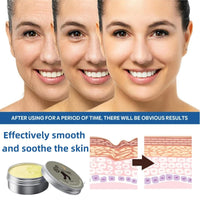 Yoowan Freckle Removal Cream,Skin Barrier Repair Cream,Oil Free Moisturiser,Anti Wrinkle Balm Instantly Lifts/Tightens/Resists Aging/Lightens Fine Lines,Deep Facial Moisturizing,Soothing,Relieve Swelling