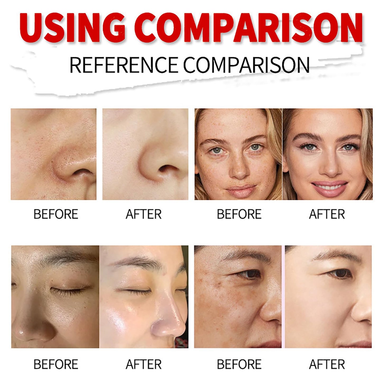 Kojic Acid Cream - Skin Lightening Cream for Anti Aging - Dark Spot Remover for Face - Hydrating Face Cream for Dry Skin - Face Moisturizer for Women - Brightening, Anti Wrinkle, Moisturising 30g