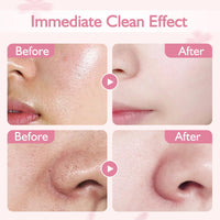 Xumann 10PCS Sakura Skincare Set, Deep Cleanse Pink Face Mask Skincare, Brightening and Moisturizing Pink Clay Mask (5g*10)