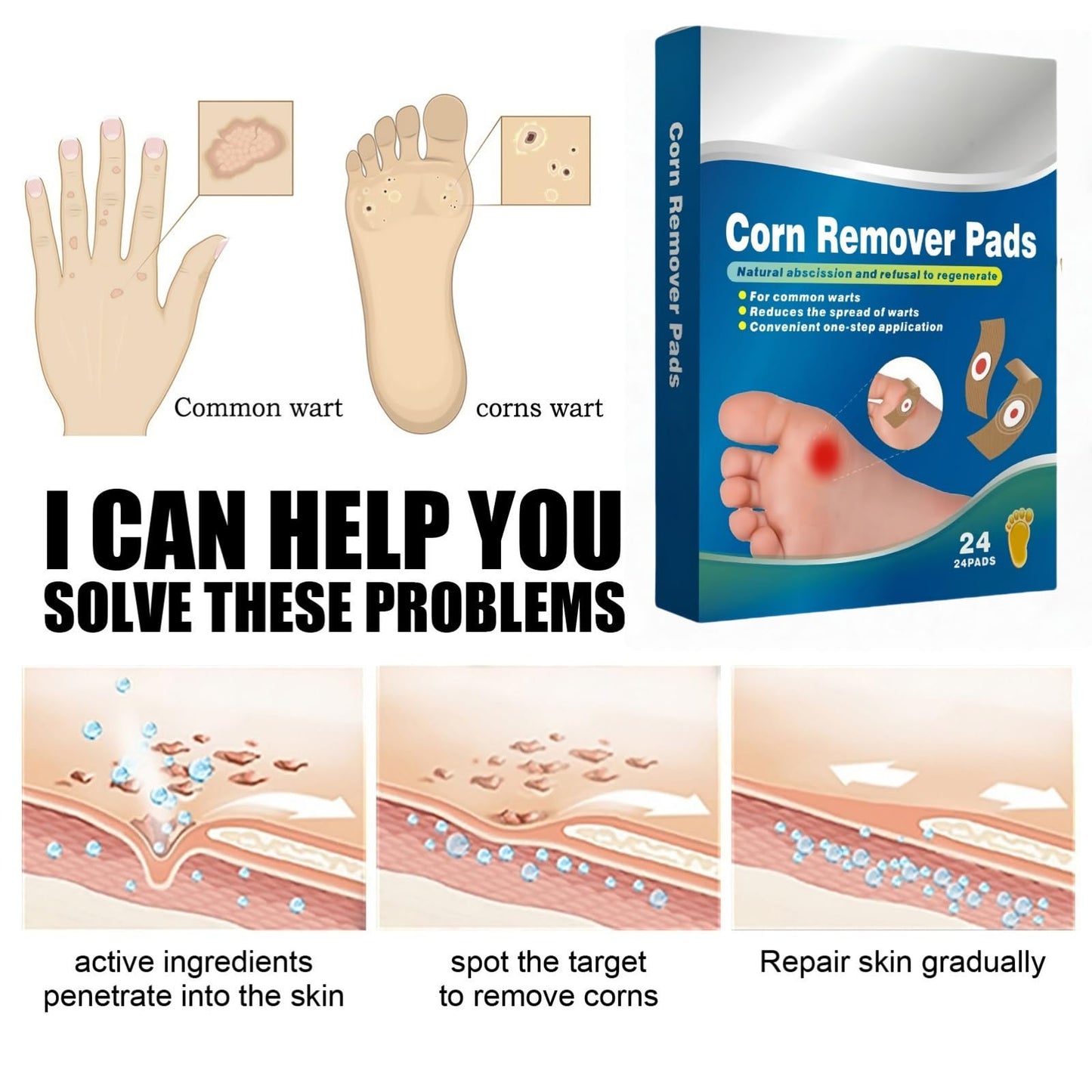 24Pcs Verruca Treatment Corn Plasters,Wart Remover,Corn Remover for Feet and Hand,Gentle and Safe Verruca Plasters,Wart Removal Patches,Foot Care for Women and Men,Pain Relief,Gentle and Skin-friendly