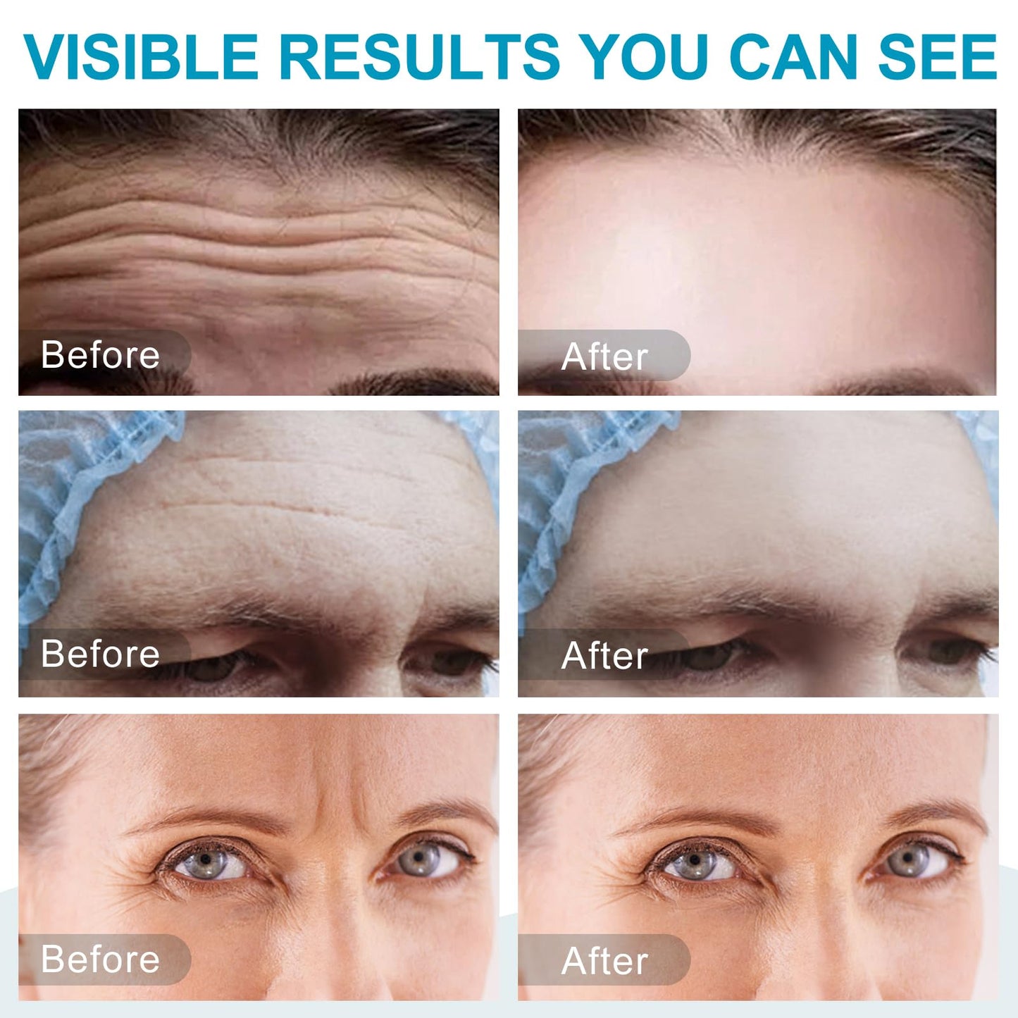 Feeliville 16PCS Forehead Wrinkle Patches, Collagen Forehead Anti Wrinkle Patches with potent anti-aging agents, for Fine Lines & Frown Lines,Moisturizing forehead & between eyes
