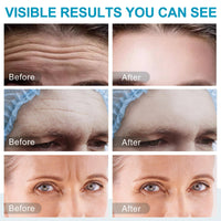 Feeliville 16PCS Forehead Wrinkle Patches, Collagen Forehead Anti Wrinkle Patches with potent anti-aging agents, for Fine Lines & Frown Lines,Moisturizing forehead & between eyes