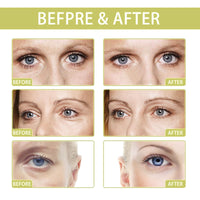 QinZiEn Lutein Eye Oil,Vitamin C Lutein E-ye Oil,Under Ey-e Cream for Dark Circles,Lu-tein Essential Oil,Tightening Eye Cr-eam,E-ye Cre-am Anti Aging,Dry Skin Moisturiser,E-ye Wrinkle Cr-eam,Moisturizer Face