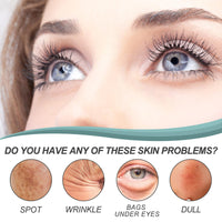 2PCS Dark Spot Remover, Dark Spot Remover For Face, Dark Spot Corrector, Age Spot Remover For Face, Pigmentation Removal Cream Prevent Forming Dark Spots, Fade Spots, Improve Skin Tone (30G*2)