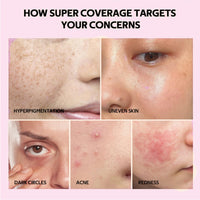 Siyinzu Peptide Balm Foundation,Peptide Bounce Balm Foun/dation,Mature Skin Found/ation,Buildable Coverage Powder Make Up,Cushion Foundati/on,Baked Foundati/on,Foundation Full Coverage for all Skin Types