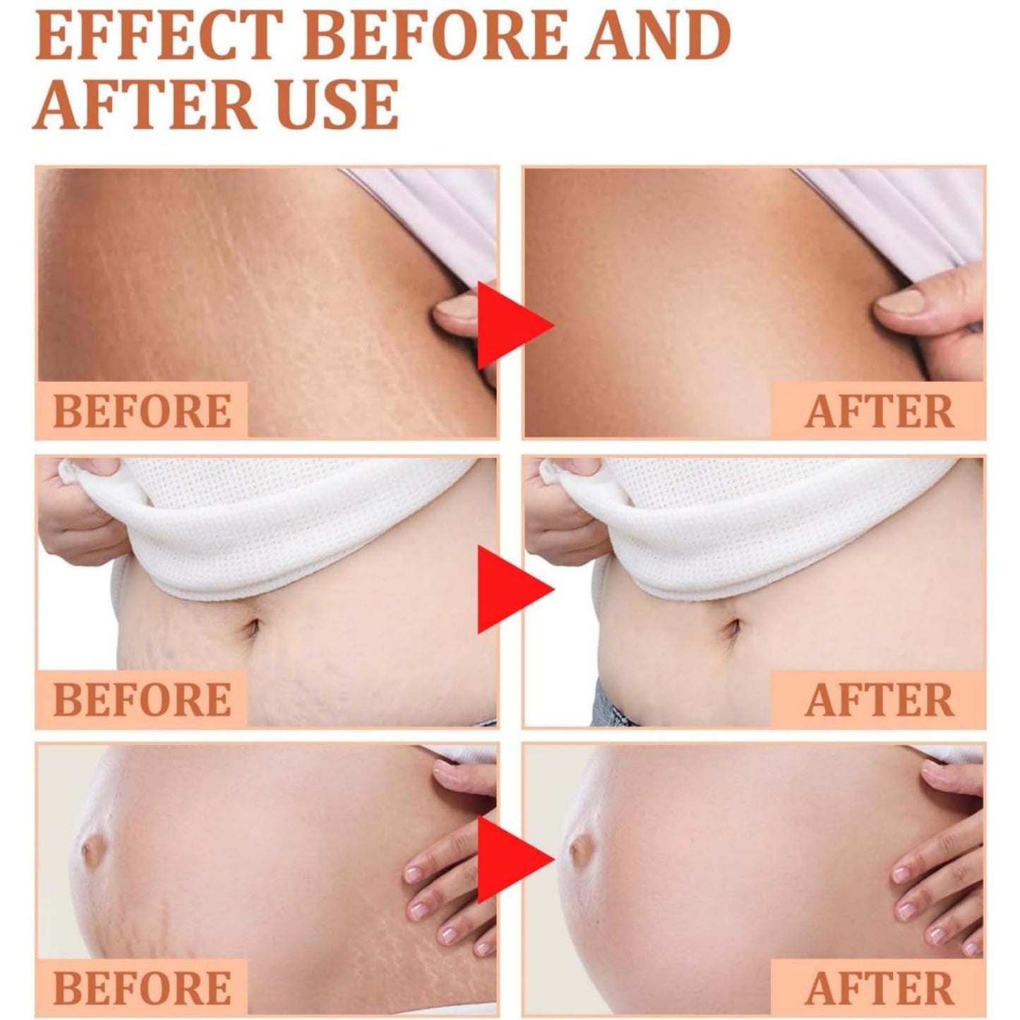 SingHao B Fl/at Belly Firming Cream,Stretch Mark & Scar Treatment Skincare Cream,Skin Firming and Tightening Body Cream,Skin Tightening Moisturizing,Skin Regenerate Cream,Stretch Marks Removal