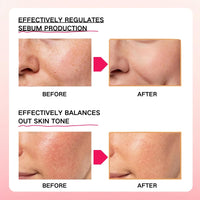 Shefave Pink Spicule Serum for Face with Niacinamide & Vitamin B12, Picotonic Glowing Serum, Anti Wrinkle Ser-um for Glass Skin, Minimizes Pores, Dark Spot, Brightening Hydrating Face Essence,Korean Skin Care