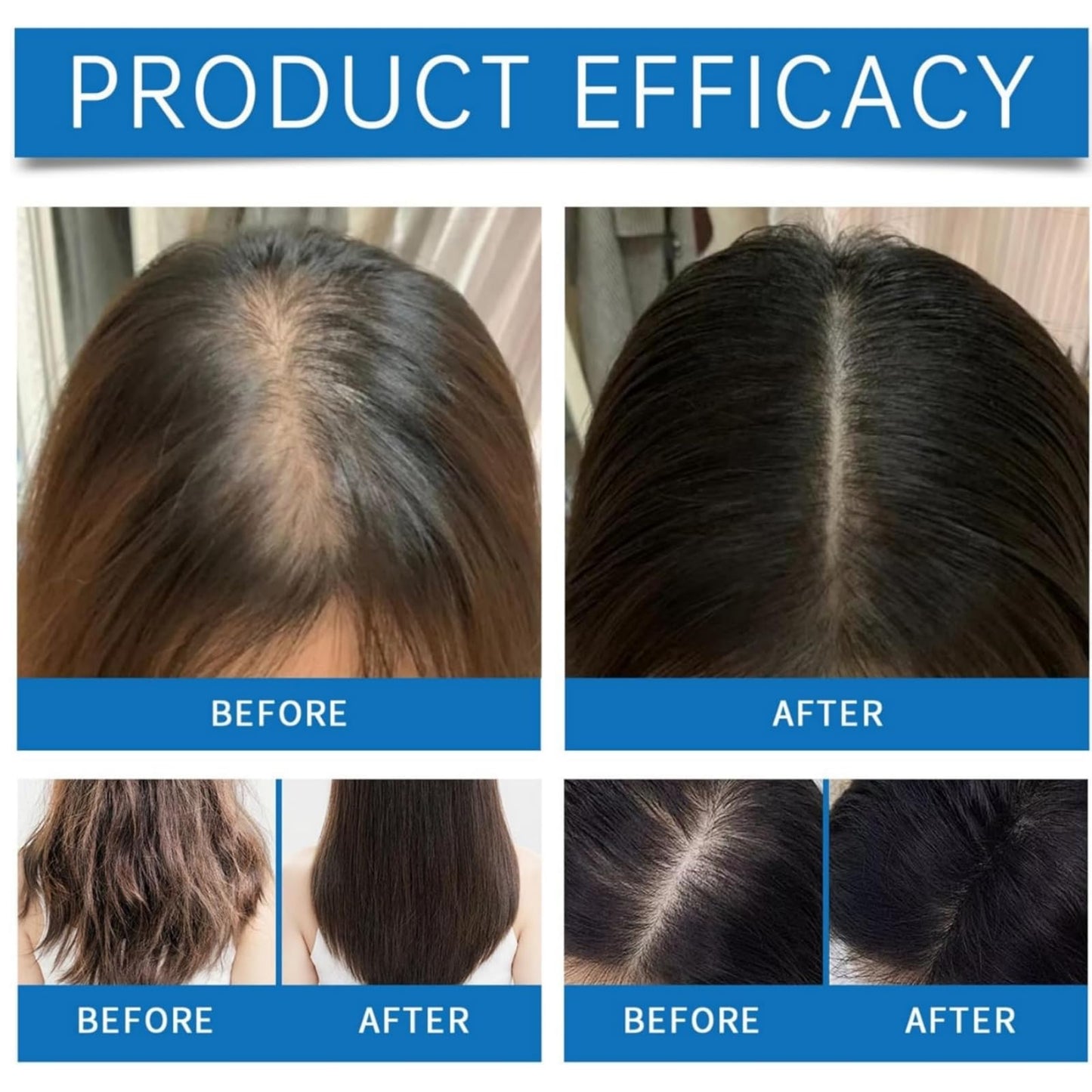 Yoowan Scalp Cooling Hair Ampoule,Hair Loss Serum,Ha-Ir Density Serum,Scalp Protector,Sca-Lp Se-Rum For Dry Sca-Lp,Strengthen & Grow,Keeps Clean And Non-Greasy,Improves Shine,Lightweight,Exfoliate