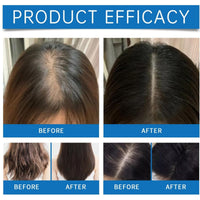 Yoowan Scalp Cooling Hair Ampoule,Hair Loss Serum,Ha-Ir Density Serum,Scalp Protector,Sca-Lp Se-Rum For Dry Sca-Lp,Strengthen & Grow,Keeps Clean And Non-Greasy,Improves Shine,Lightweight,Exfoliate