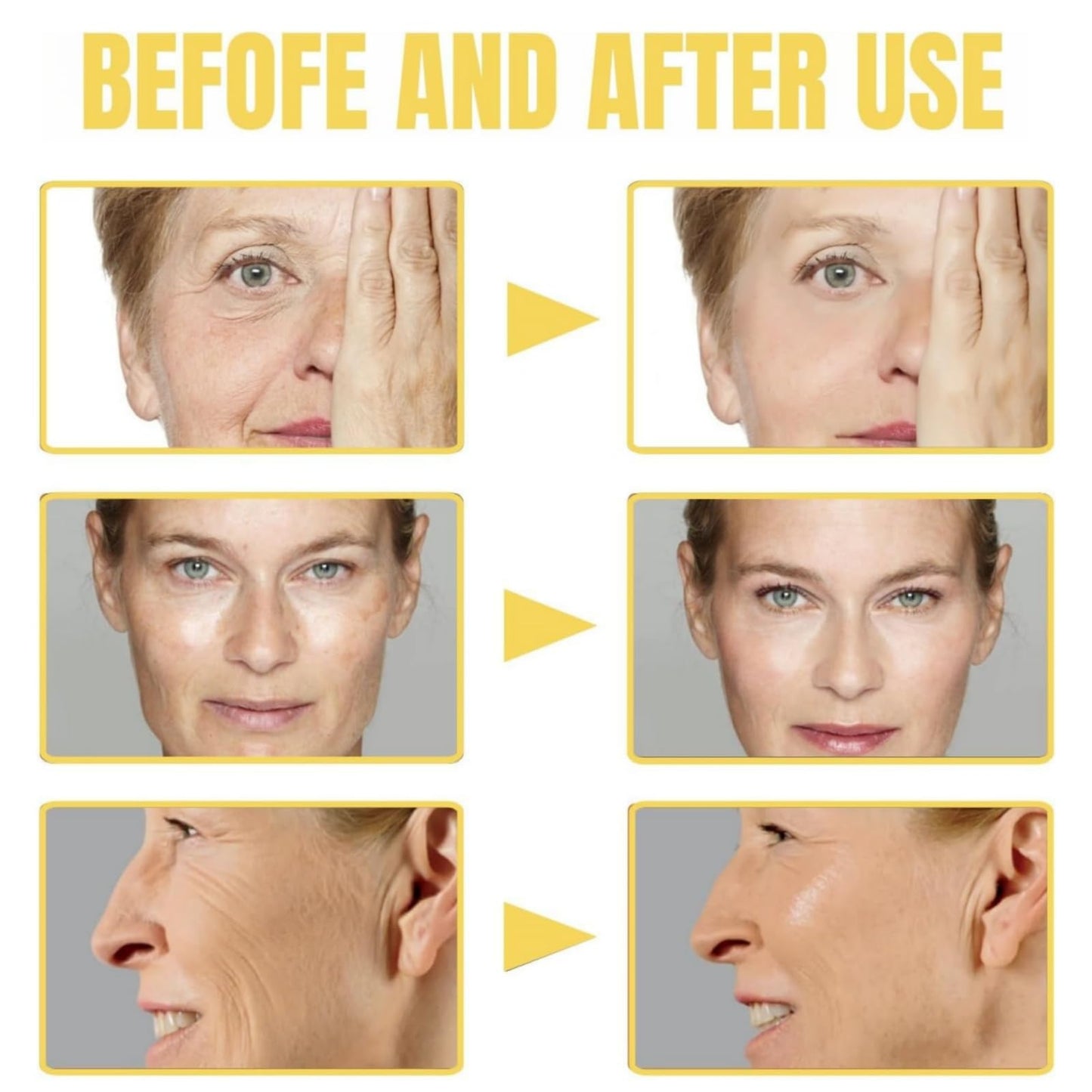 Yoowan Frankincense Resin Infused Oil For Face,Frankincense Oil For Skin,Frankincense Oil,Frankincense Resin Oil,Frankincense Oil For Skin Organic,Cold Pressed Serum Hydrates Skin,Face Body Oil For Women
