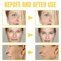 Yoowan Frankincense Resin Infused Oil For Face,Frankincense Oil For Skin,Frankincense Oil,Frankincense Resin Oil,Frankincense Oil For Skin Organic,Cold Pressed Serum Hydrates Skin,Face Body Oil For Women