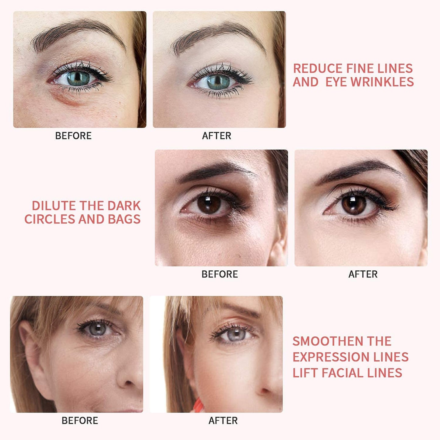 RETIMAX 1500 Vitamin A, Retinol, Protective Ointment, Anti-Ageing 30g