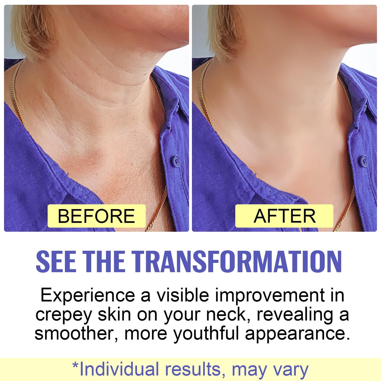 Neck Firming Cream - Anti-Aging Neck Cream for Tightening and Wrinkles for an Even Skin Tone and Neck Lift (50ml)