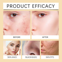 Brightening Face Wash, Turmeric Kojic Acid Foaming Facial Cleanser, Turmeric Face Wash with Brush, Foaming Face Cleanser Women for Skin Tone, Reduce Blemish & Acne, Gentle Cleanser for Hydrate Skin