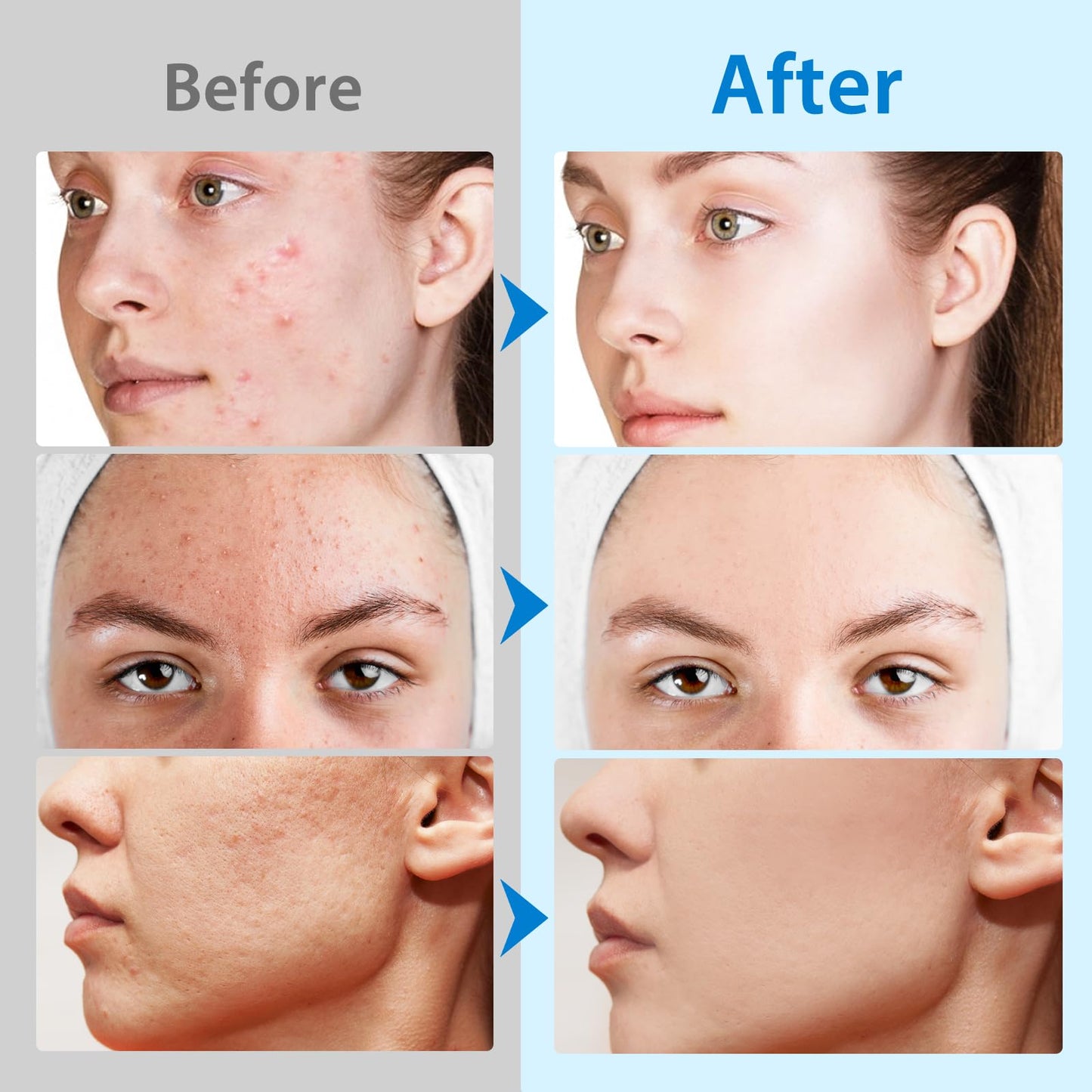 ZyranovaE Glycolic Acid Pads,Glycolic Acid Peel Pads with 10% Ultra Pure Glycolic + 2% Salicylic Acid,Cleansing Pads for Face & Body with Vitamins B3, C & E, Green Tea, Calendula, Allantoin - 40 Pads