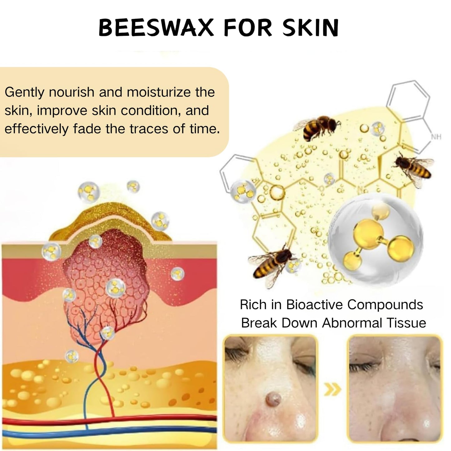 IZBEAUVO Bee Venom All-in-One Cream, BeeVenom SkinTreatmentCream with Allantoin & Mint | Lightweight Non-Greasy Formula | Improves Skin Texture & Skin mole Remover | Bee Venom Cream for All Skin Types | 60g