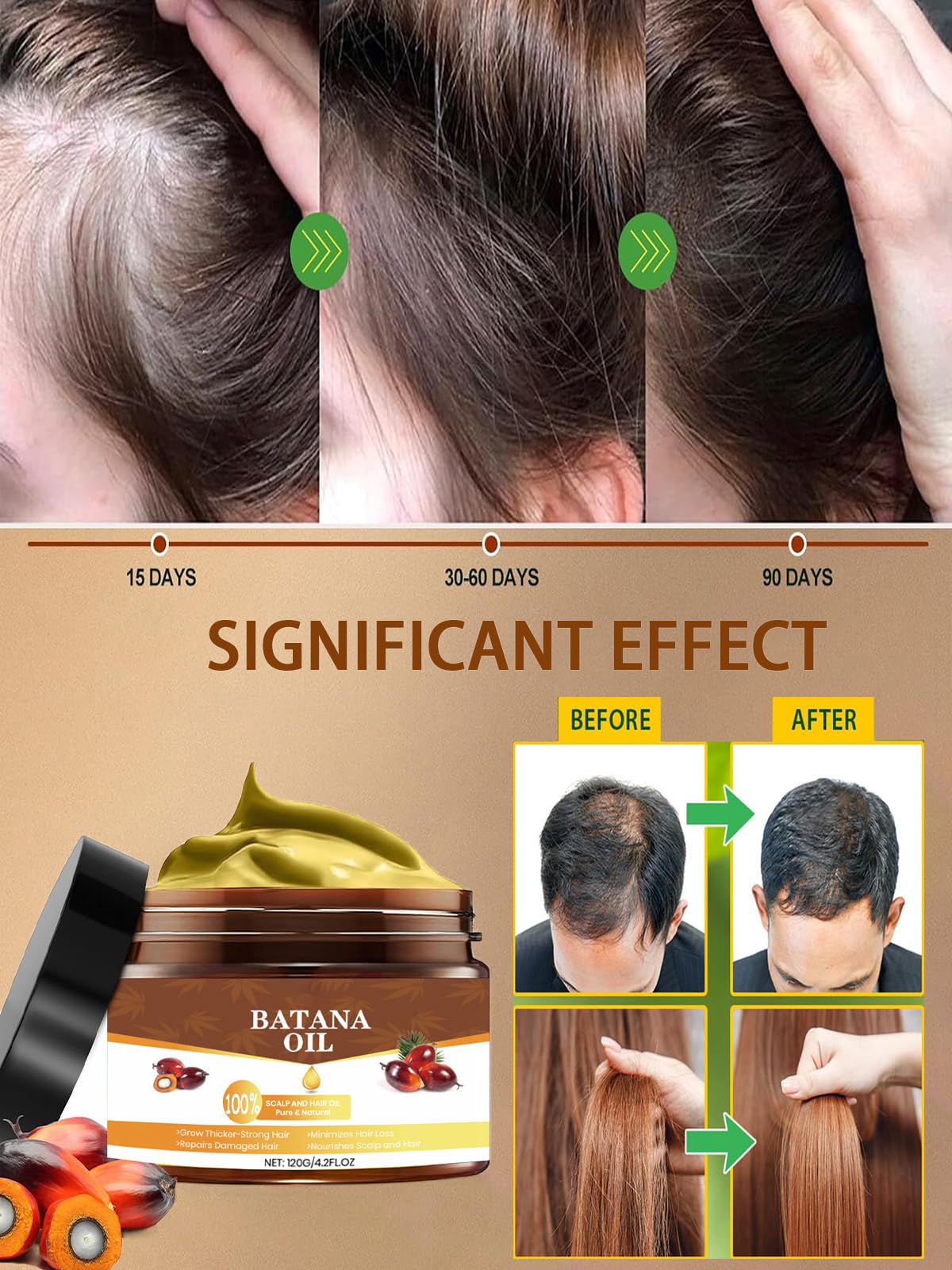 MYSHELL 100% Raw Batana Oil for Hair Growth, Unrefined Dr. Sebi Batana Oil from Honduras, Prevents Hair Loss, Natural and Pure Hair Growth Oil, Hair Treatment for Curly Hair,Enhances Hair Thickness