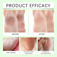 DMQ Urea Cream 40% for Feet Plus 2% Acid, Urea Foot Cream, Tea Tree and Aloe Vera for Deep Moisture - Foot Cream for Cracked Heels and Dry Skin, Cracked Heel Repair Cream Skin Care for Hands & Feet