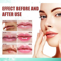 Fankayi Cold Sore Treatment Cream,Co/ld So/re Cream for Lips,Rapid Relief for Cold Sores,Mouth Ulcer Treatment for Adults,Mouth Ulcer Treatment,Mouth Th-Rush Cure for Adults,Coldsore Cream for Lips