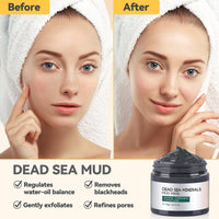 Face Masks Skincare, Clay Mask Kit, 3-Set Turmeric Vitamin C Clay Mask, Dead Sea Mud Mask, Green Tea Deep Cleanse Mask for Detoxing, Reducing Acne, Oil Control, Dark Spots, Pores and Blackheads