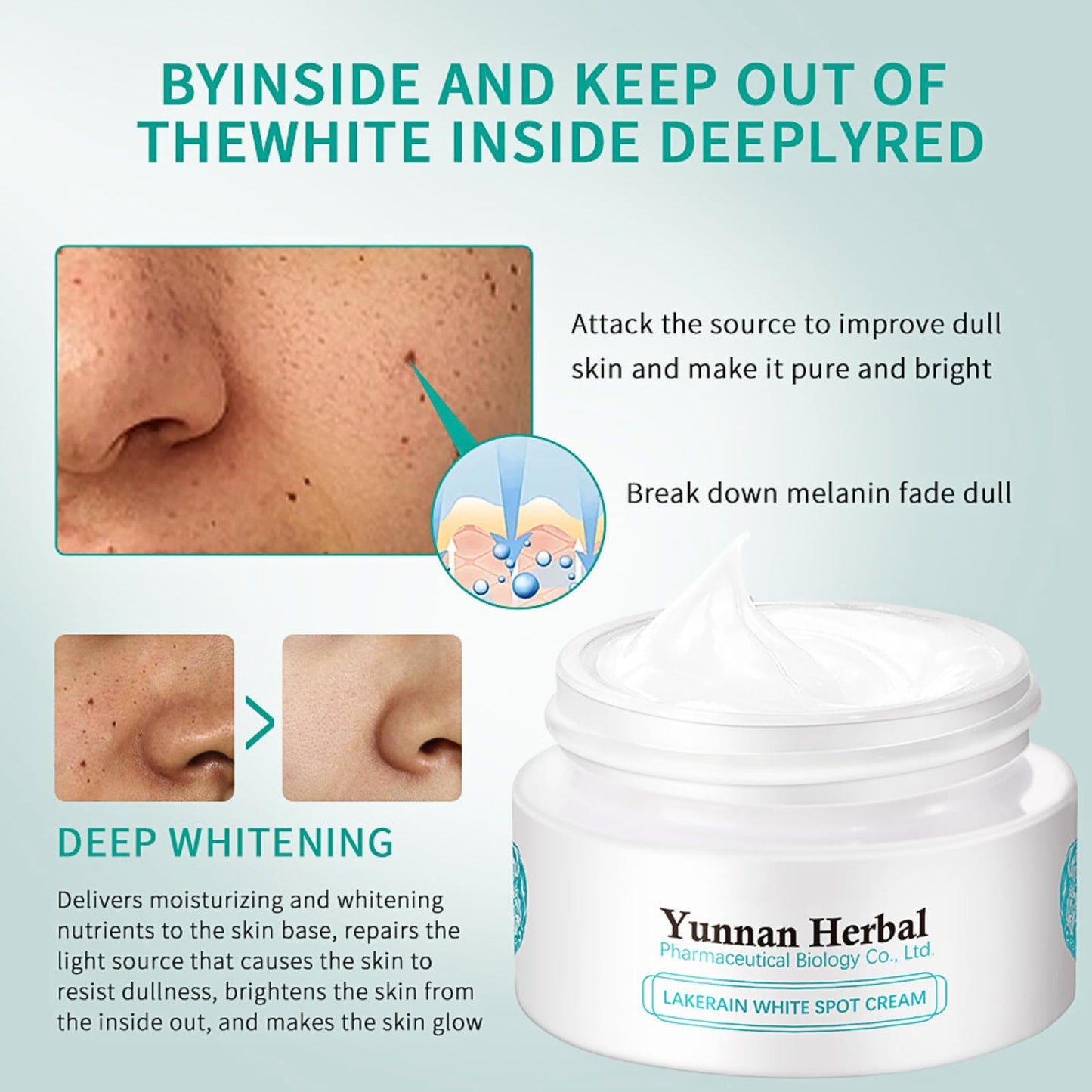 Yunnan Herbal Melasma Cream, Dark Spot Remover for Face Spot Cream, Freckle Removal Cream with Arbutin Niacinamide, Sun Spots, Freckles, Blemish Melasma Treatment for Face Cream, 20g