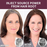 Fankayi Bata-na Hair Mask, Bata-na and Rosemary Oil Promote Hair Growth,Moisturize and Achieve A Natural Shine,Repair Damage and Restore Health and Vitality,Prevent Hair Loss,for All Hair Types,Hair Gain Mask