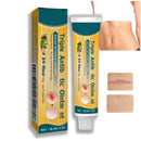 OuXing Wound Healing Oint-Ment,Relieve Skin Abrasions,Natral Healing Cream,Promote Skin HEA/ling Cream,Scab He/aling Cr/eam,Wo/und Cre/am Fade Scars,Wo/und He/aling Crea/m,Body Cre/am,WOU/nd Protection