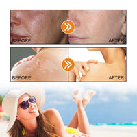 Siyinzu Sun Cream SPF 100,Sunscreen SPF 100+ PA+++,UVB/UVB High Protection SP/F 100 Face Moisturiser,Broad Spectrum Uv Protection For Face/Body,Waterproof Fac/e Sunscreen,Non-Greasy Suncream Factor 100