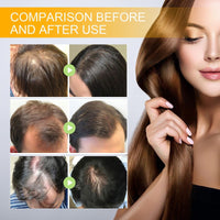 Fankayi Men and Women Hair Growth Serum,Hair Serum for Hair Growth,Hair Loss Treatment for Men and Women,Reduces Hair Loss,Hair Ser/um for Ha/ir Gr/owth,Ha/ir Gr/owth Products