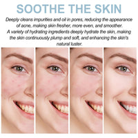 QinZiEn Youthful Formula Ultimate Moisturizing Cream,Moisturiser Face Women,Anti Wrinkle Face Cream,Calming F-ace Moisturizer,Repairing Fa-ce Moisturizer,Hydrating Mo-isturiser F-ace
