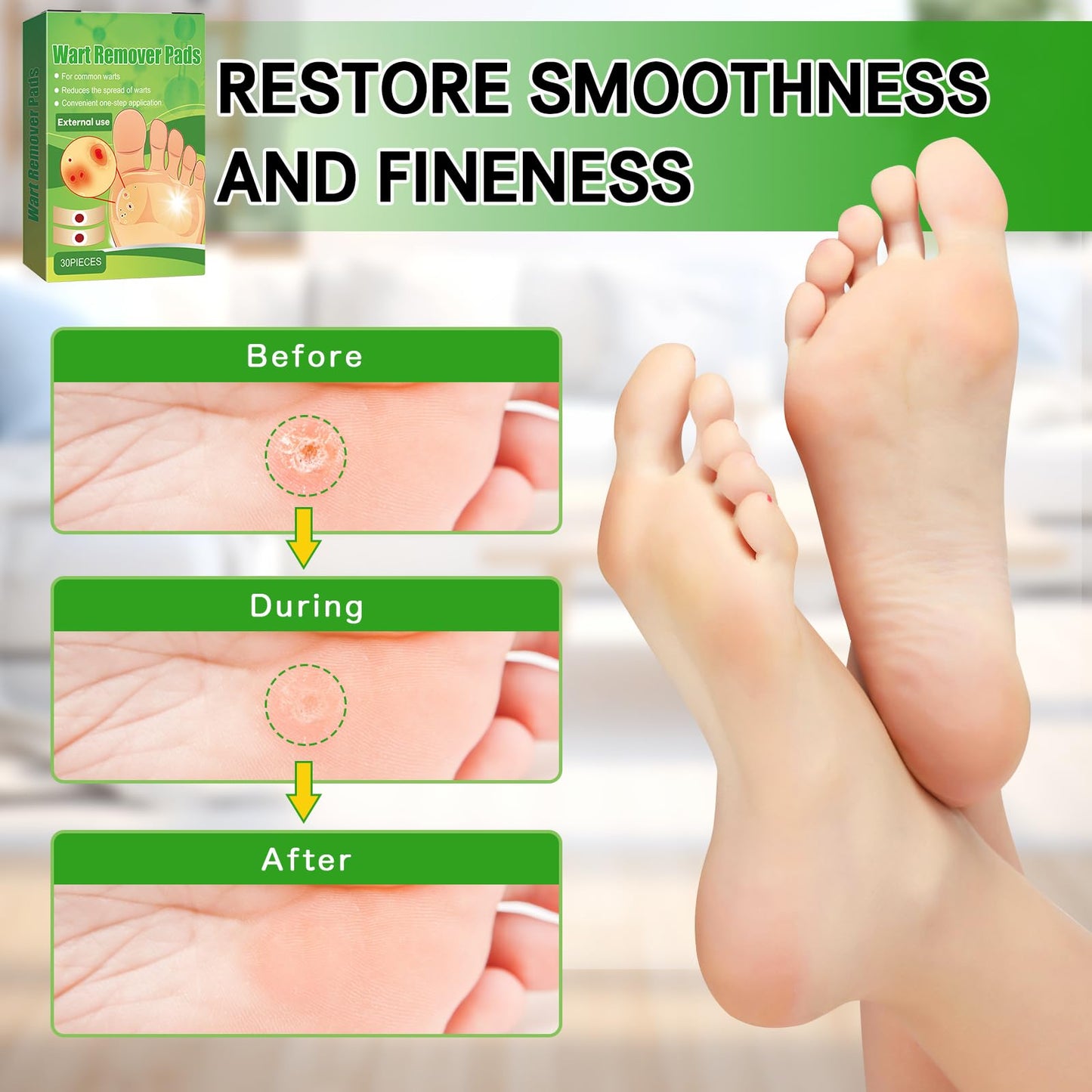 Soneat Wart Remover, 30pcs Verruca Treatment, Plantar Wart Remover for Hands, Feet, Effective Deep Verruca Removal Pads Patches, Pain Relief, Non-irritating Wart Treatment for Adults