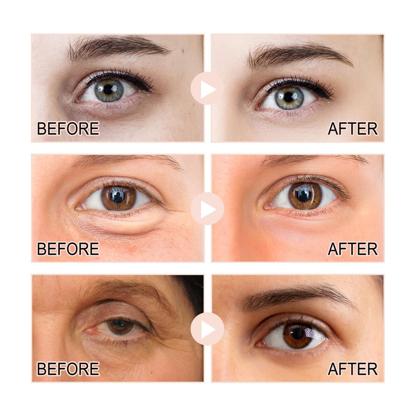 Retinol Intense Reactivating Eye Cream,Retinol Eye Cream,Dark Circles Under Eye Treatment Women,Anti Aging Eye Cream,Eye Cream for Dark Circles and Puffy Eyes,Eye Bags Remover,Eye Cream for Wrinkles
