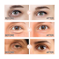 Retinol Intense Reactivating Eye Cream,Retinol Eye Cream,Dark Circles Under Eye Treatment Women,Anti Aging Eye Cream,Eye Cream for Dark Circles and Puffy Eyes,Eye Bags Remover,Eye Cream for Wrinkles