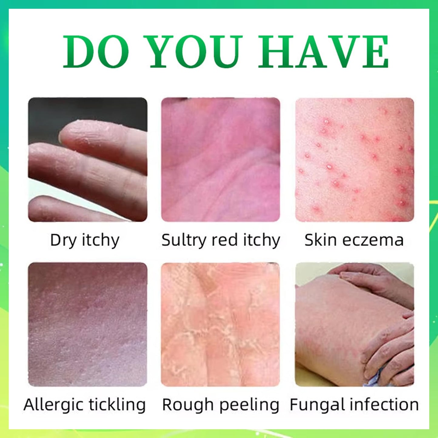 Athlete's foot Treatment cream - anti fungal foot cream for dry Feet, cracked heel Treatment & Athletes foot cream extra strong