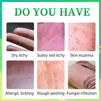 Athlete's foot Treatment cream - anti fungal foot cream for dry Feet, cracked heel Treatment & Athletes foot cream extra strong