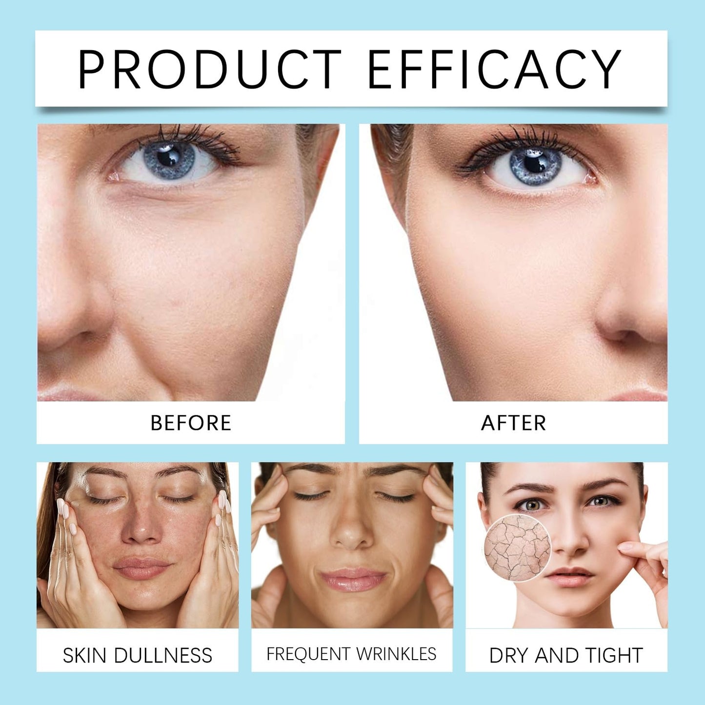 QinZiEn Youthful Formula Ultimate Moisturizing Cream,Moisturiser Face Women,Anti Wrinkle Face Cream,Calming F-ace Moisturizer,Repairing Fa-ce Moisturizer,Hydrating Mo-isturiser F-ace