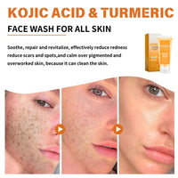 IZBEAUVO Kojic Acid & Turmeric Face Wash,Kojic Acid Foaming Cleanser,Deep Cleansing Brightening Face Wash,Foaming Facial Cleanser for Exfoliating, Unclog Pores, Acne Scars, Smooth Skin for All Skin Care