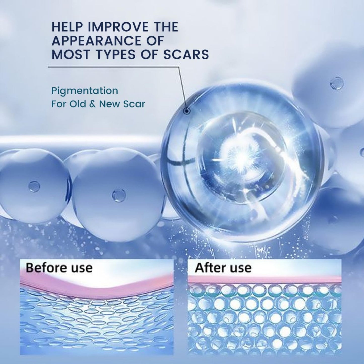 Shefave-Scar Cream-Skin Care Cream-Removal-Lavender-3PCS