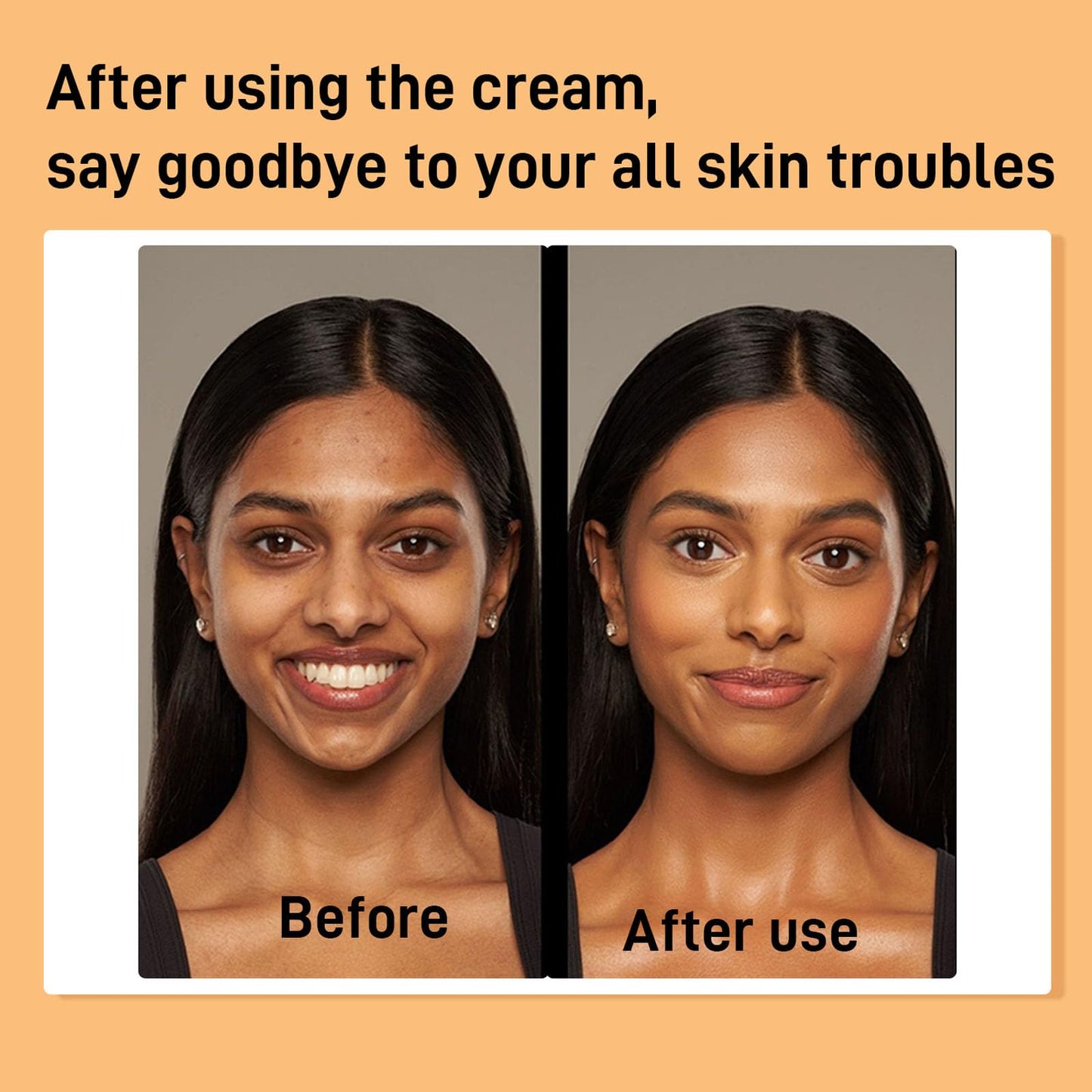 Turmeric Kojic Acid Face Cream- Natural Turmeric Skin Brightening Lotion for Face & Body, Anti-Aging Cream Turmeric Face Moisturizer for Dark Spots, Dry Skin Hydrating, Firming, Even Tone