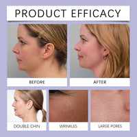 Joro/ndy Anti-Wrinkle Skin Cream for Remove Wrinkles,Skin Firming Face Cream,Skin Tightening Cream,Instant Tightening Face Cream,Skin Tightener Anti Wrinkle Firming Cre/am,Hydrating Facial Moisturizer