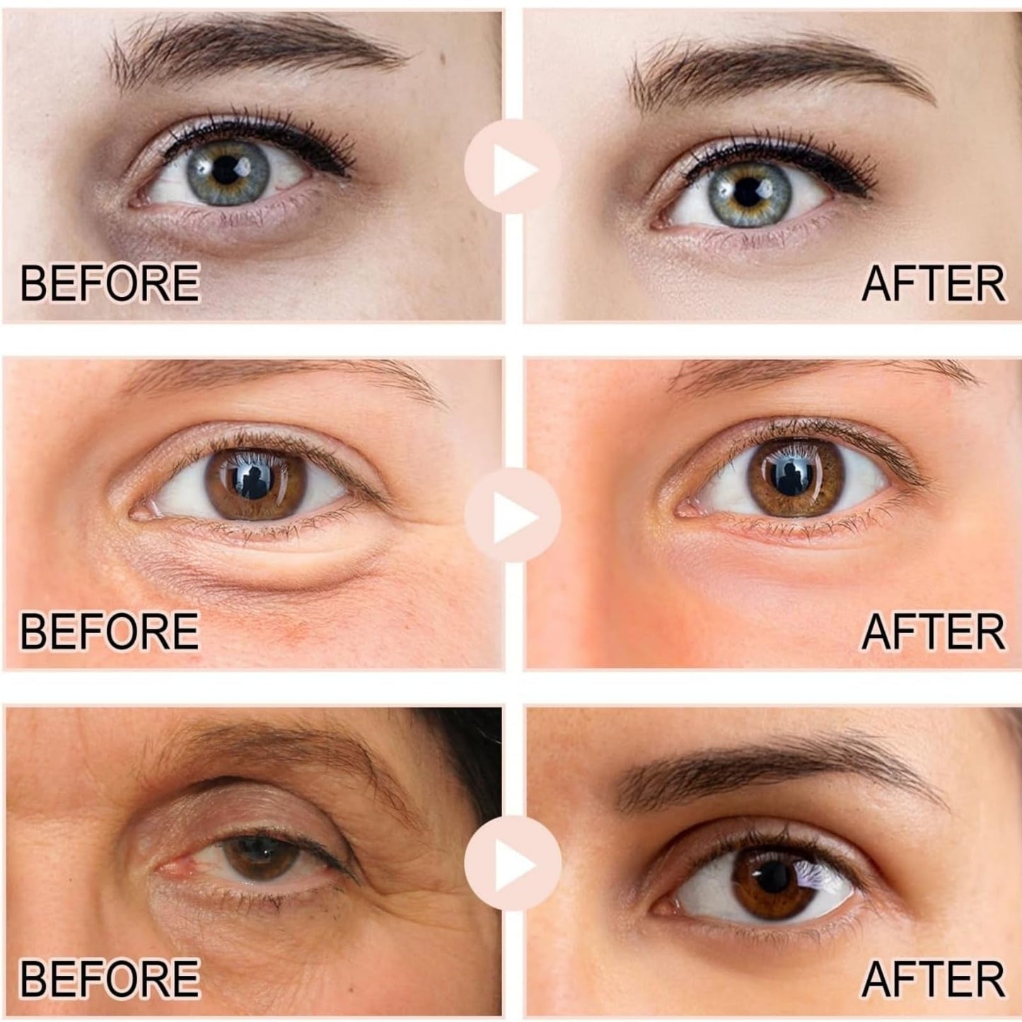 Yoowan Ret-Inol Eye Cream For Face And Neck,Ret-Inol Eye Cream,Reti-Nol Firming Serum,Reti-Nol Ey-E Serum,Anti-Aging Lotion,Under Eye Brightener,For Dark Circles And Puffy Eyes,Reduce Fine Lines