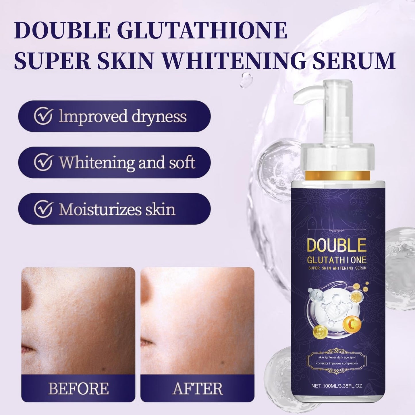 Cureluxe Glutathione Serum - Glutathione Dark Spot Correcting Serum - Skin Whitening Face Seru_m with Niacinamide & Kojic Acid - Glutathi_one Anti Aging Ser_um Improve Skin Tone & Elasticity