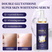 Cureluxe Glutathione Serum - Glutathione Dark Spot Correcting Serum - Skin Whitening Face Seru_m with Niacinamide & Kojic Acid - Glutathi_one Anti Aging Ser_um Improve Skin Tone & Elasticity